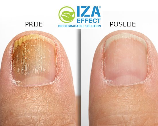 iza effect spray trattamento purificante xxl (2x100ml) iza effect spray trattamento purificante xxl (2x100ml)